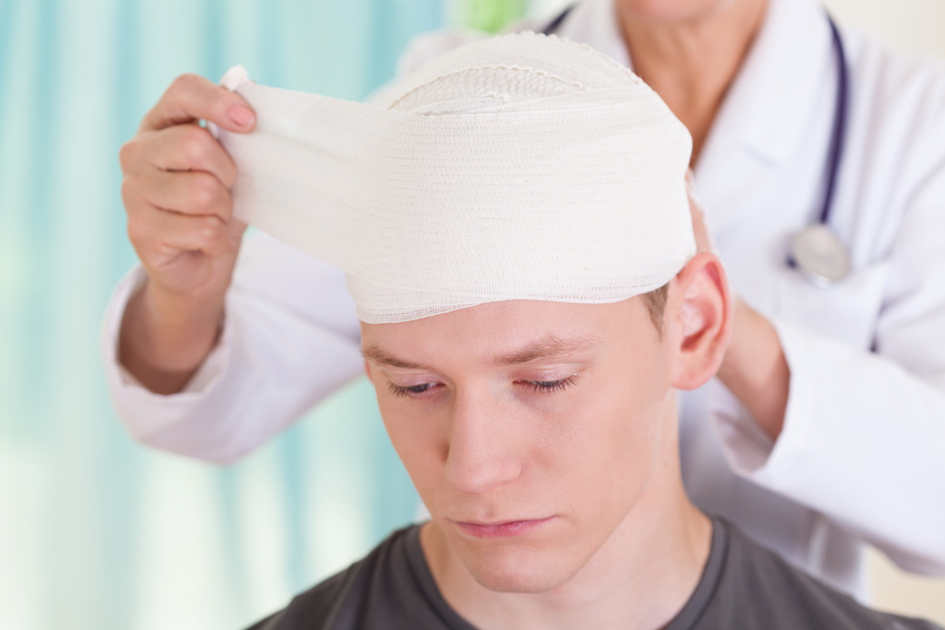 Here’s What You Need to Know When Hiring a Head Injury Lawyer